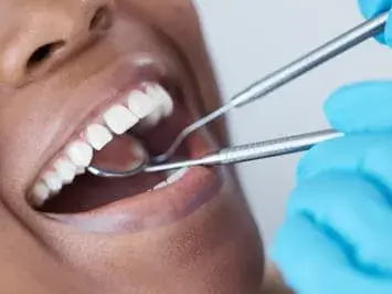 Limpeza Profissional